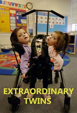 連體雙胞胎 第一季/Extraordinary Twins Season 1線上看